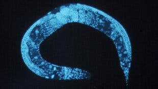 0921_c_elegans The roundworm C. elegans, used in some aging studies. (c) Wikimedia Commons, National Human Genome Research Institut