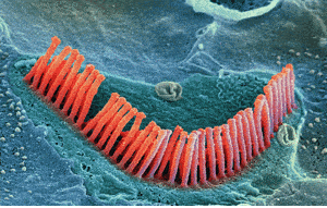 hair-cells-hearing-loss Hair cells located in the organ of corti, in the cochlea of the inner ear.(c) SPL / Photo Researchers, Inc