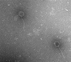 12026-Evolution2Photo-hmed-1235p.grid-3x2 Four genetic mutations in viruses like these two lambda viruses led them to find a new way to attack their bacterial hosts. (c) Center for Advanced Microscopy, MSU