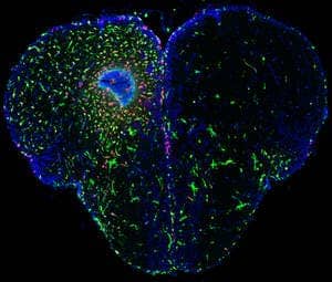 zebrafish-brain-regeneration In the injured hemisphere of the zebrafish brain (left) you can recognize the inflammation: the leukocytes (white blood cell, green) enter the damaged area in order to prevent inflammation. In addition, you can see the active radial glia cells (red). (c) CRTD