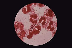 Gonorrhea under a microscope. Image: courtesy of CDC/Susan Lindsley