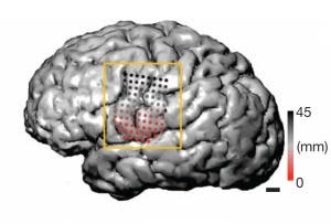 Electrodes in an epilepsy patient's brain (shown here in magnetic resonance imaging) revealed strikingly different patterns of activity in the articulation of consonants and vowels. (c) Nature