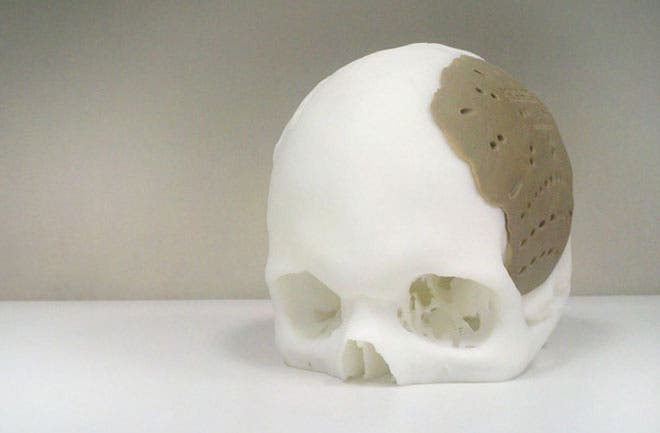 3-d-printed-skull-660