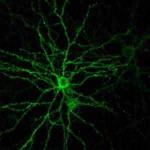 A neuron cultured for the study. Via Yale University.