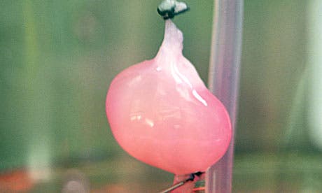 A kidney in a bioreactor after seeding with cells. After transplantation it filtered blood and produced urine. Photograph: Ott Lab/Center for Regenerative Medicine