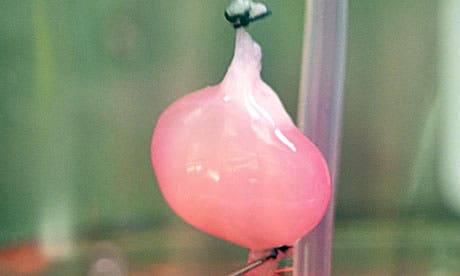 A kidney in a bioreactor after seeding with cells. After transplantation it filtered blood and produced urine. Photograph: Ott Lab/Center for Regenerative Medicine