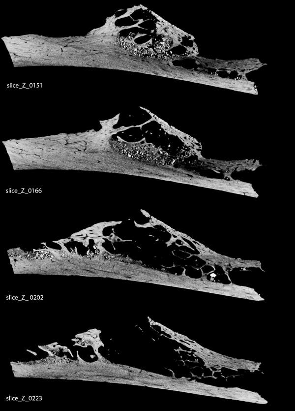 micro ct scan krapina