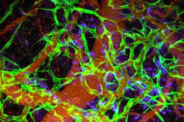 This laser microscopy image shows iPSC-generated endovascular cells in green, connective tissue cells in blue, and red blood cells in red. (c) PNAS