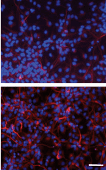 Evidence that RMST is necessary for neuronal differentiation: overexpression of RMST led to a 3-fold increase in neuron-specific beta tubulin (bottom) compared to control (top). Scale bars represent 100 microns. (Credit: Shi-Yan Ng et al./Molecular Cell)