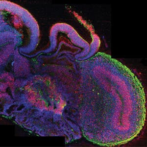 Brain like tissue developed in lab