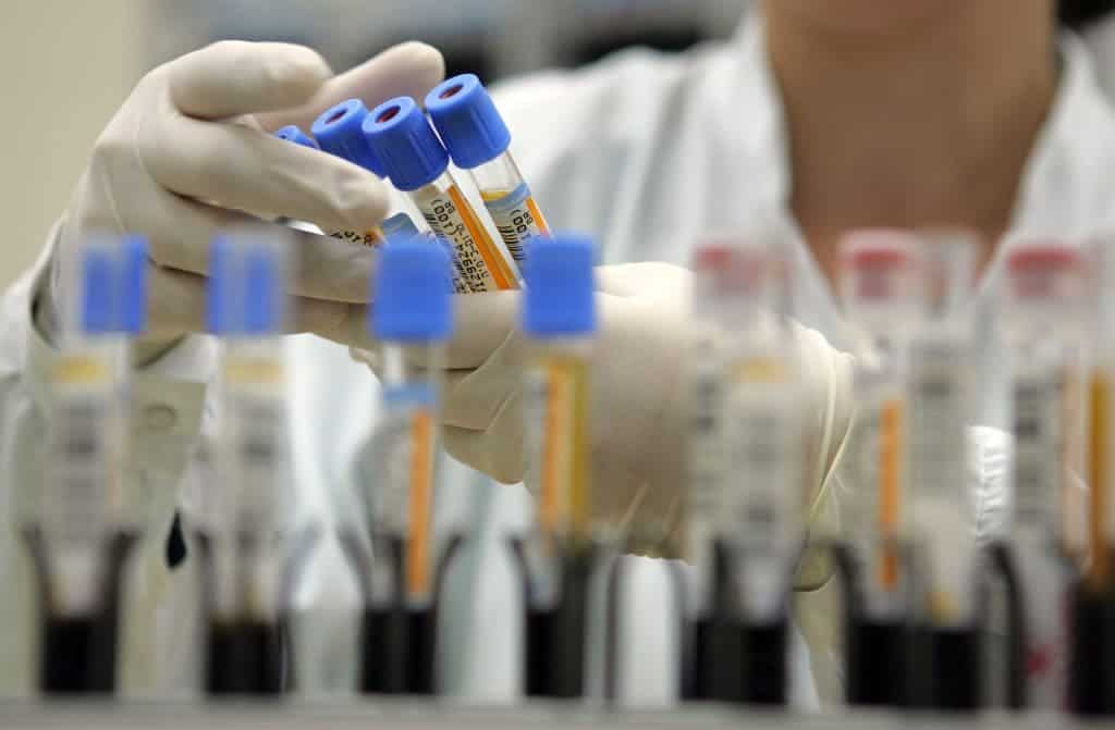 hiv_lab