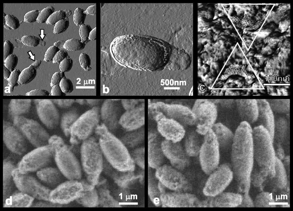 bacterial_infection