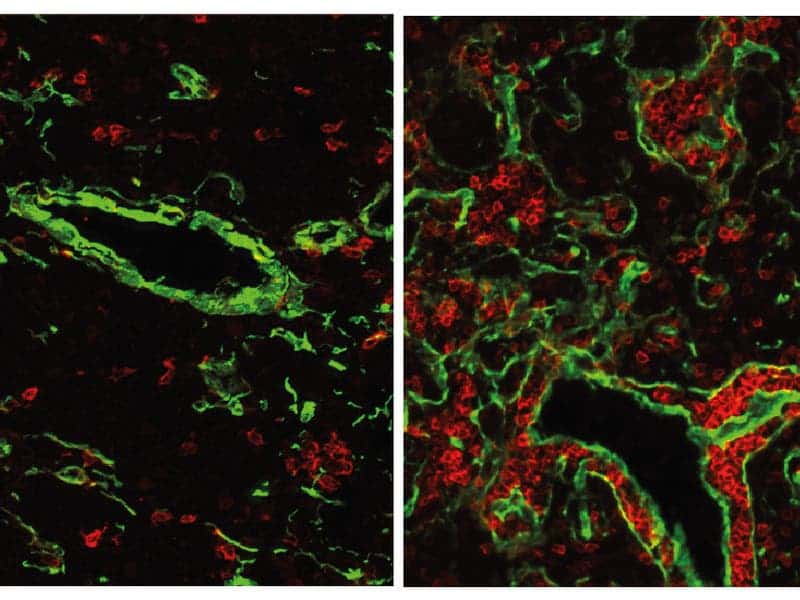 The normal mouse thymus (left) contains only a small fraction of B-cells (red). If the gene FOXN4 is activated, a fish-like thymus with many B-cells develops. Image: Max Planck