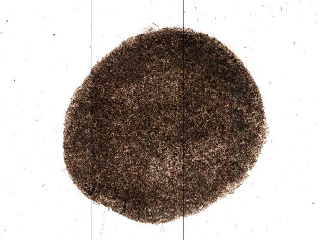 Researchers were able to grow sheets of retinal tissue from induced pluripotent stem cells, and have now implanted them for the first time in a patient.
