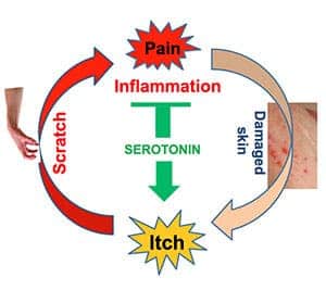 A vicious cycle: Scratching an itch causes minor pain, which prompts the brain to release serotonin. But serotonin also reacts with receptors on neurons that carry itch signals to the brain, making itching worse. Credit: WASHINGTON UNIVERSITY CENTER FOR THE STUDY OF ITCH