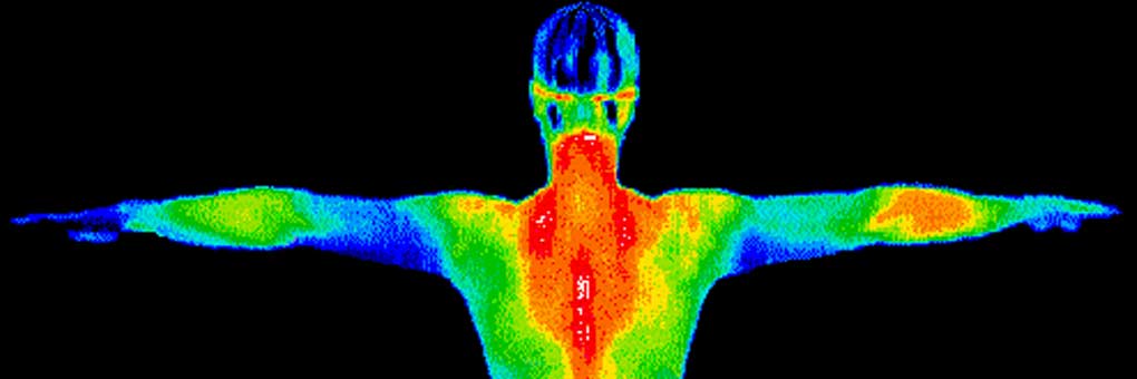 A thermal image visually represents the difference in temperature across various surfaces on a body. Image: Wikimedia