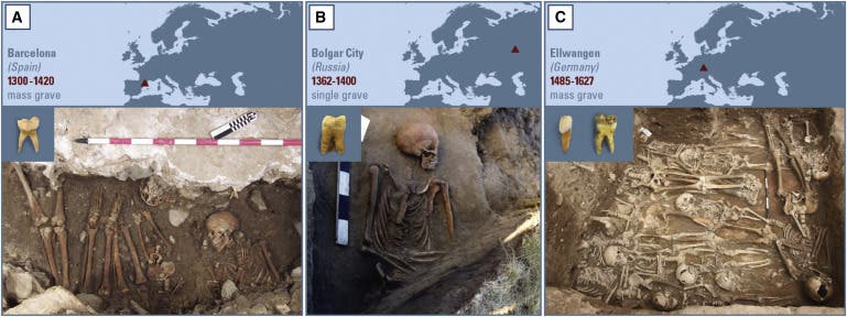A) Tooth sample that was positive for Y. pestis (3031) and mass grave picture from the plague burial in Barcelona. (B) Y. pestis-positive tooth sample and picture of infected individual (2370) from the Ust’-Ierusalimsky tomb of Bolgar City. (C) Picture of mass grave in Ellwangen, and two tooth samples from individual 549_O, found positive for the plague bacterium. Credit: Cell