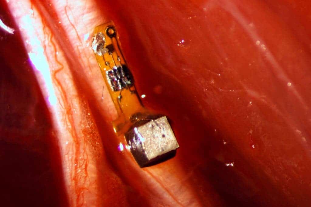 The sensor, 3 millimeters long and 1×1 millimeters in cross section, attached to a nerve fiber in a rat. Credit: University of California, Berkeley