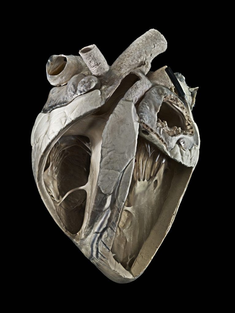Cow Heart. Image credits Michael Frank / Royal Veterinary College