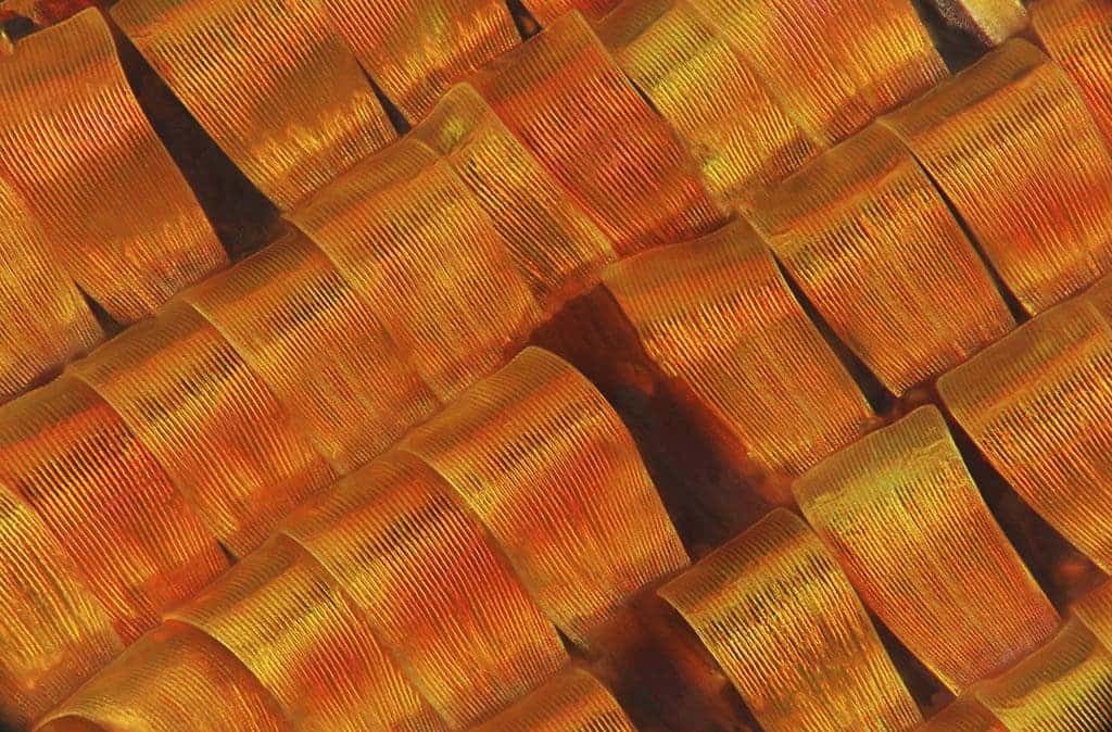 Credit: Macroscopic Solutions. Wellcome Images
