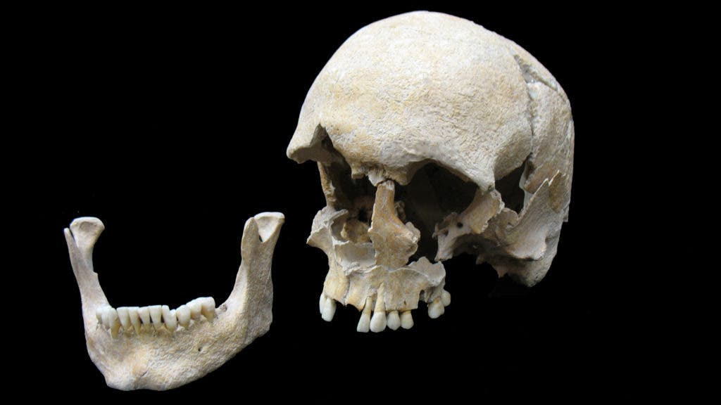 Skull of a plague victim whose DNA was extracted by the Harvard researchers. Credit: STATE COLLECTION OF ANTHROPOLOGY AND PALAEOANATOMY MUNICH