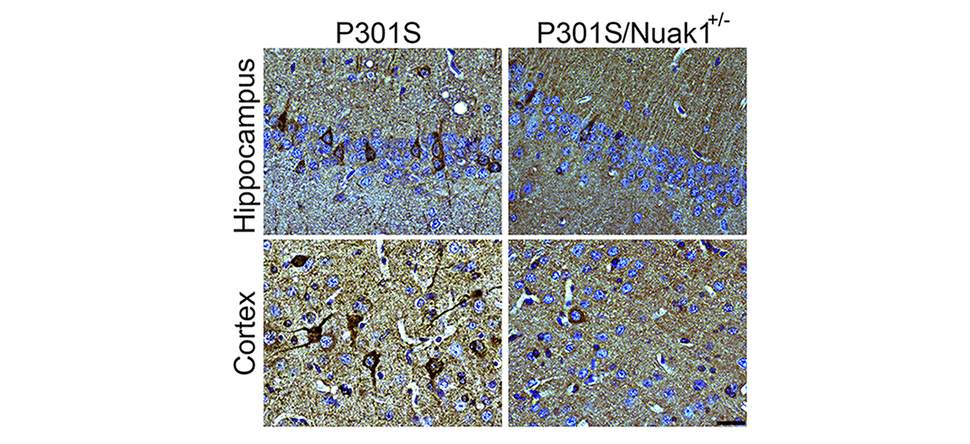 Brain section from mouse carrying the dementia-causing P301S mutation in human tau shows accumulation of tau neurofibrillary tangles (in dark brown, left). When Nuak1 levels are decreased by 50% (P301S/Nuak1+/-; right), fewer tau tangles accumulate. Credit: Cell
