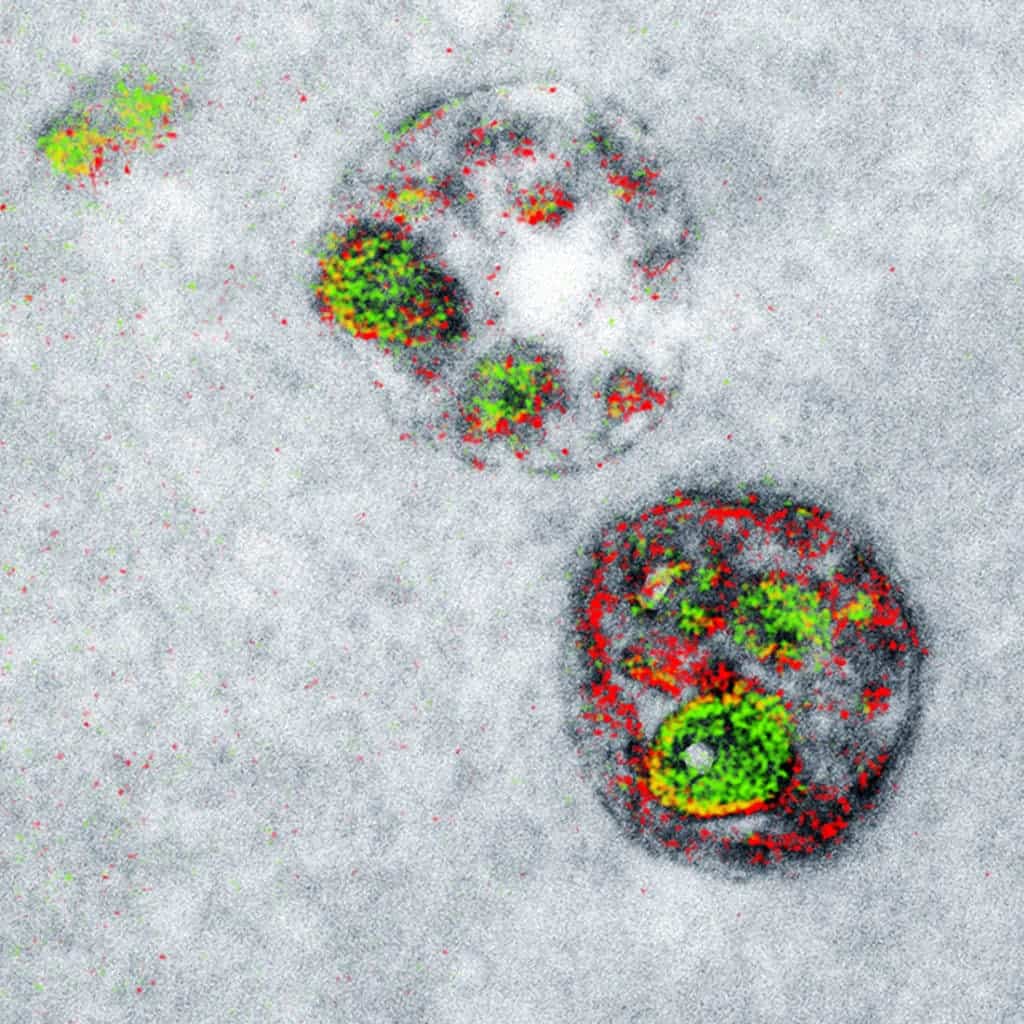 A two-color electron microscopy image of endosomal uptake of peptide proteins, a first of its kind. Credit: Cell Chemical Biology