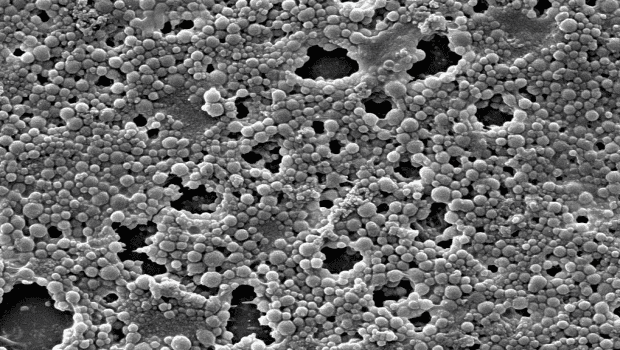 Biofilm on the septum/housing of a needleless connector. Image courtesy of Marcia Ryder, RN, MS, PhD