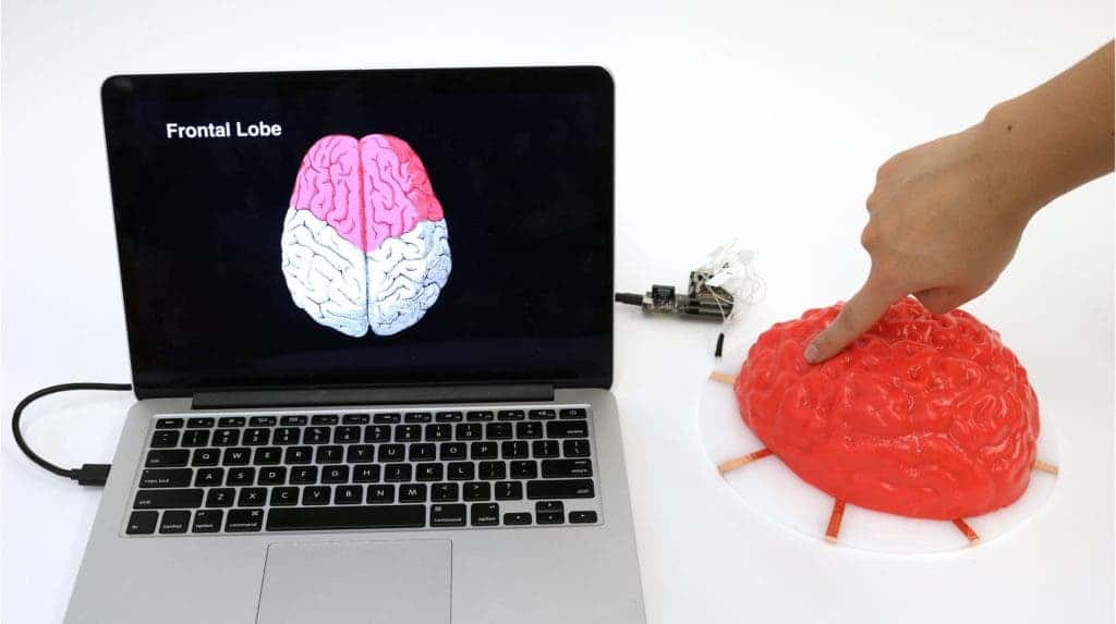 Electrick brain.