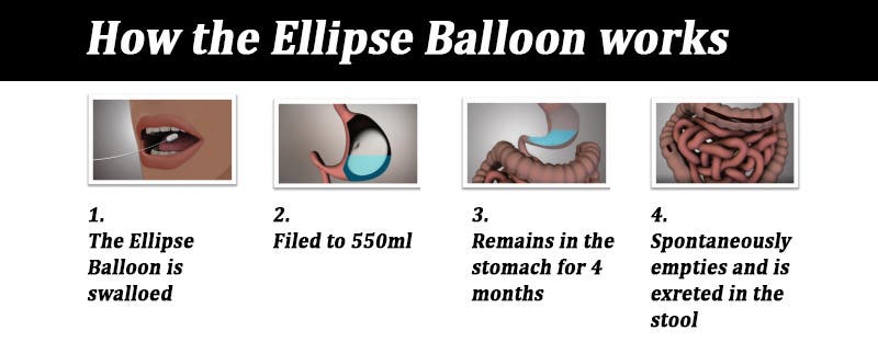 ellipse balloon