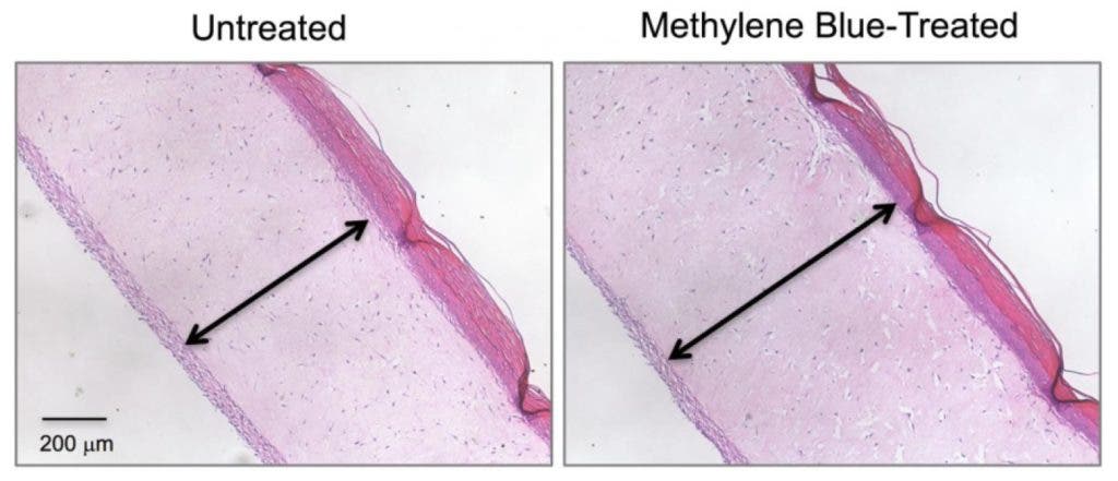 Untreated model skin (left panel) shows a thinner dermis layer (black arrow) compared with model skin treated with the antioxidant methylene blue (right panel). Credit: Zheng-Mei Xiong/University of Maryland.