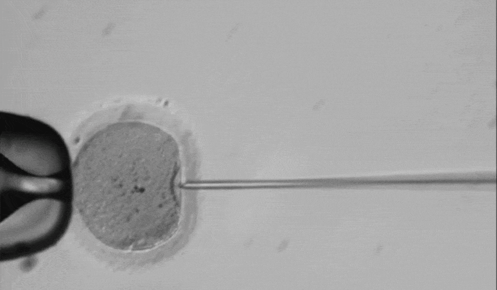 A video shows the injection of gene-editing chemicals into a human egg near the moment of fertilization. The technique is designed to correct a genetic disorder from the father. Credit: MIT Tech Review.