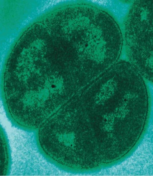 Picture of petri dish with bacterial culture