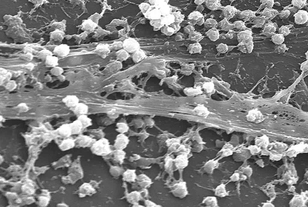 Biofilm under microscope