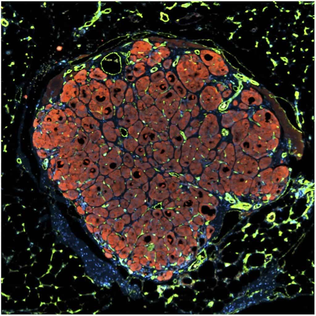 Liver cells.