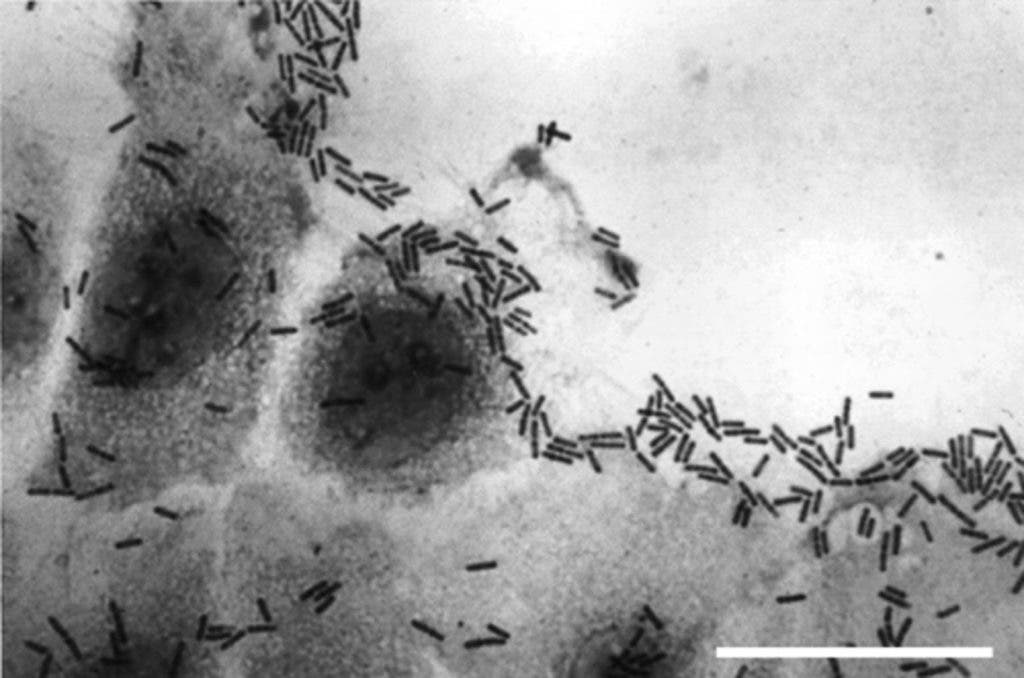Clostridium vs Human Cell.