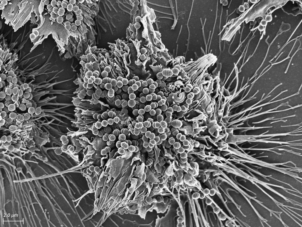 Strep. aureus.