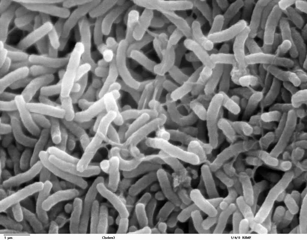 cholera_bacteria_nise-1