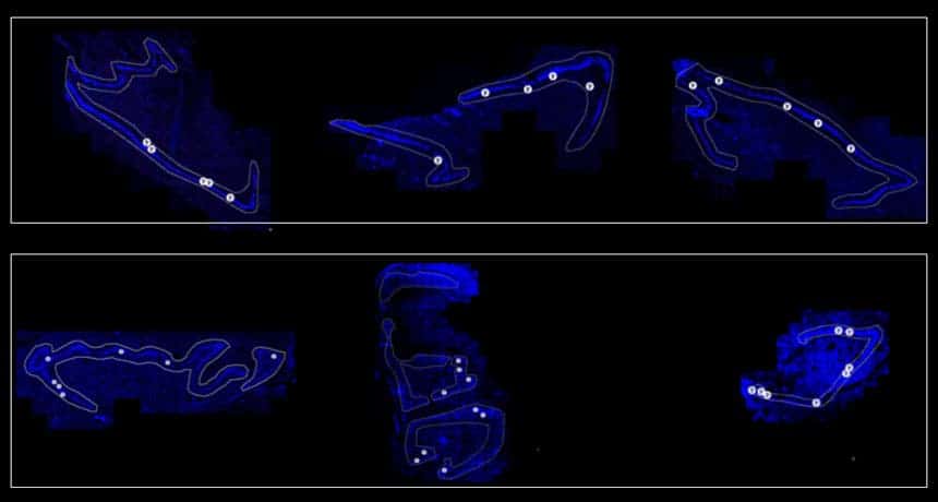 Dots represent new nerve cells. Roughly the same number of dots exist in the hippocampus of both people in their 20s (top) and in their 70s (bottom). Credit: Columbia University.