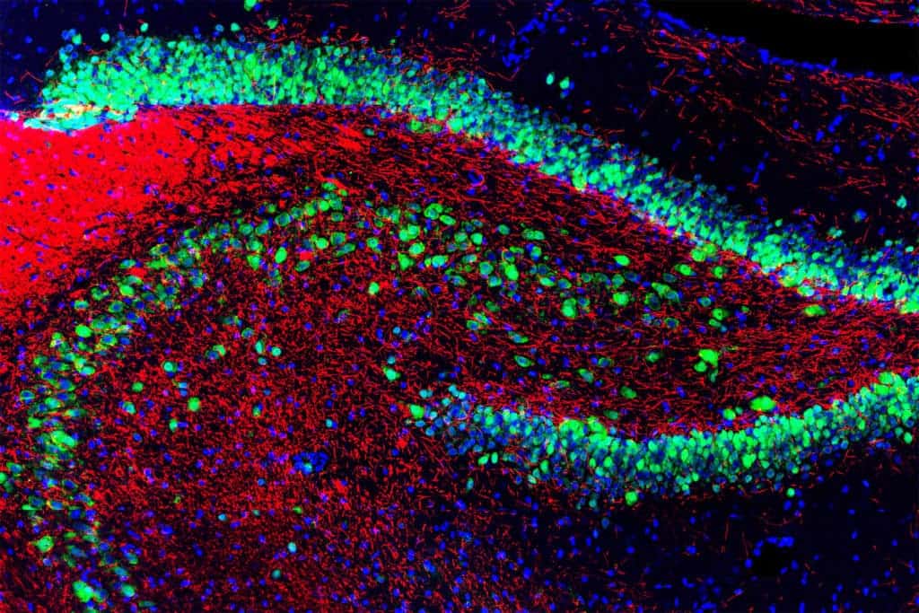 Rat Hippocampus.