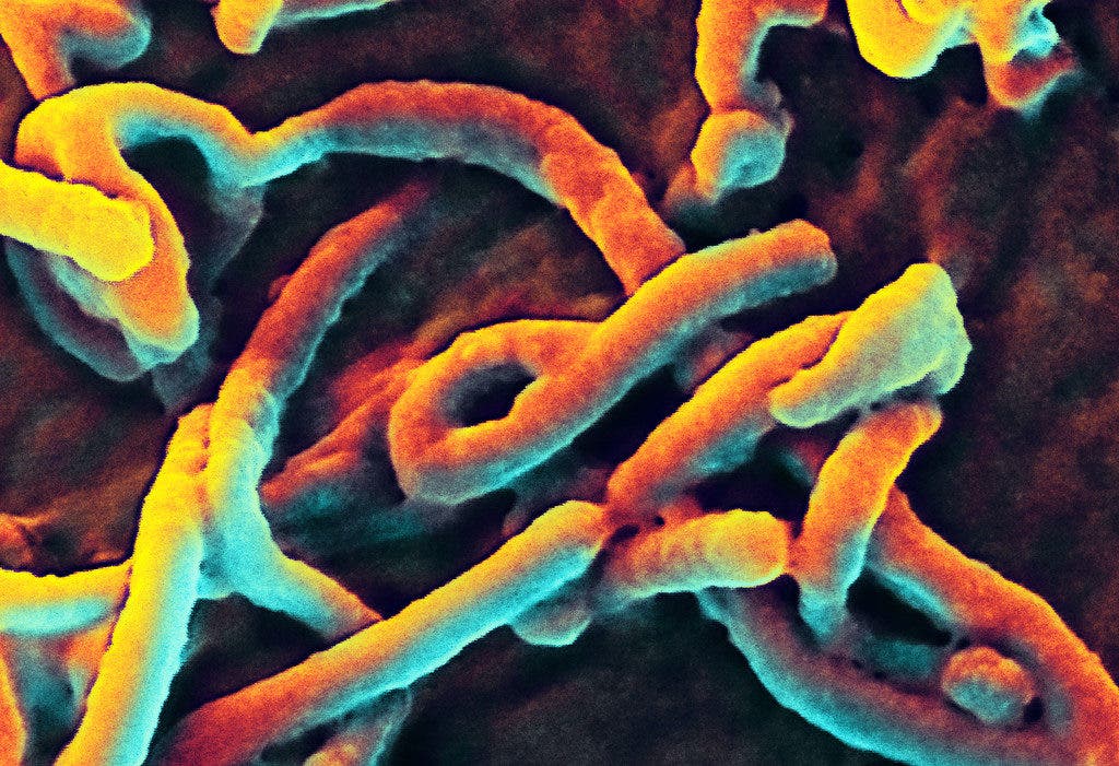 Ebola virus.