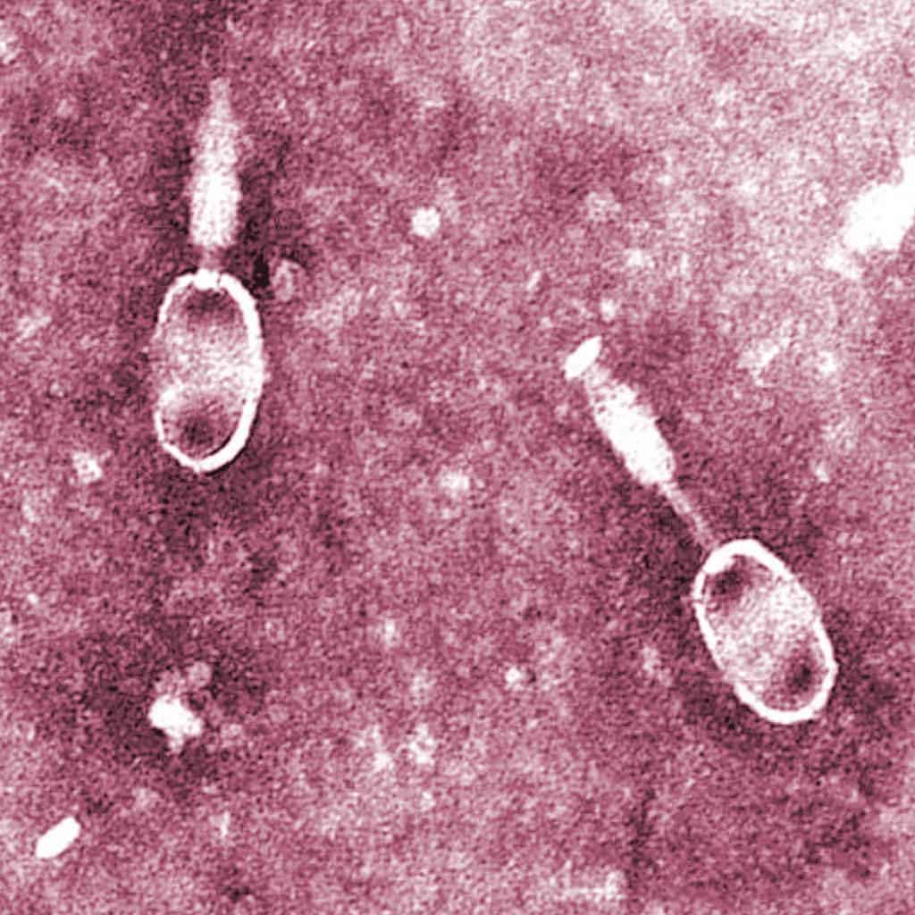 Salmonela phage.