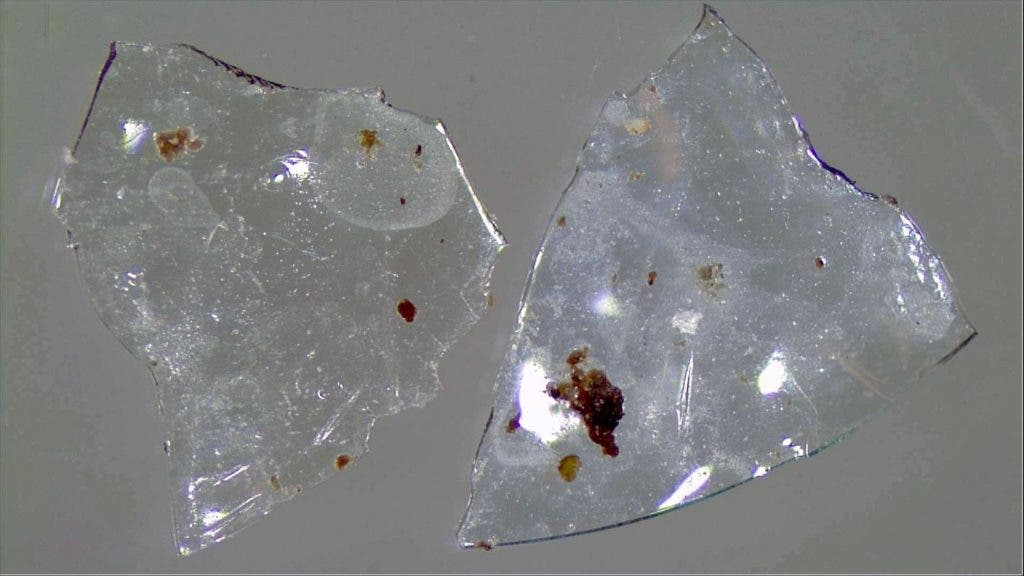 contact lens.