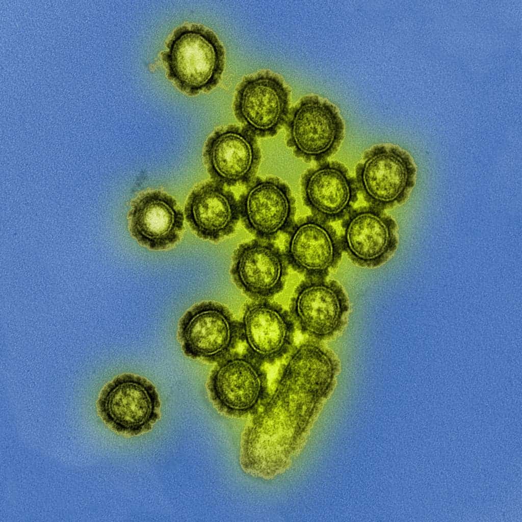 Colorized transmission electron micrograph showing H1N1 influenza virus particles. Surface proteins on the virus particles are shown in black. Credit: NIAID, Flickr. 