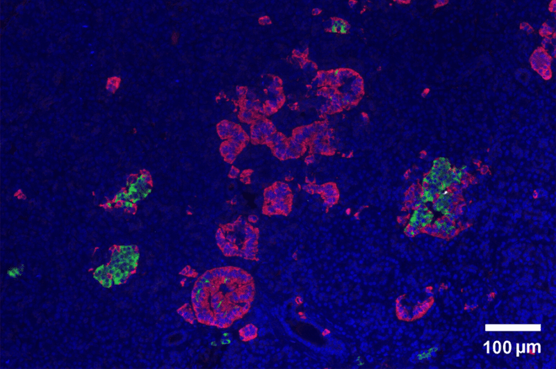 Pancreatic cells islets.