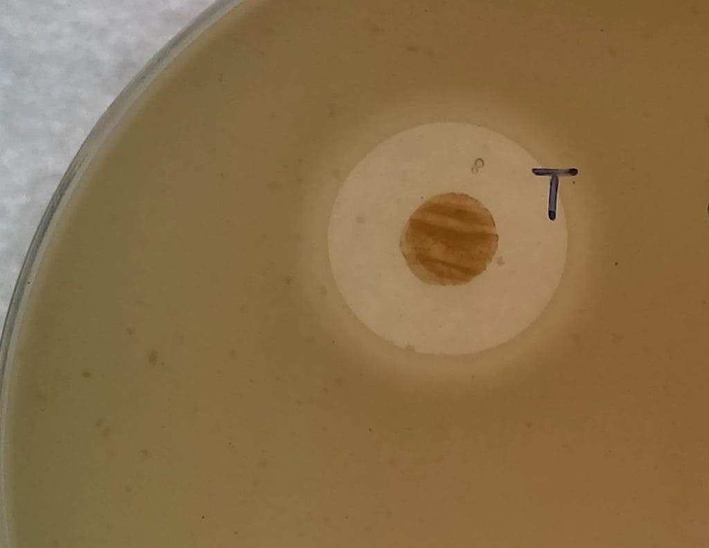 New bacteria strain.
