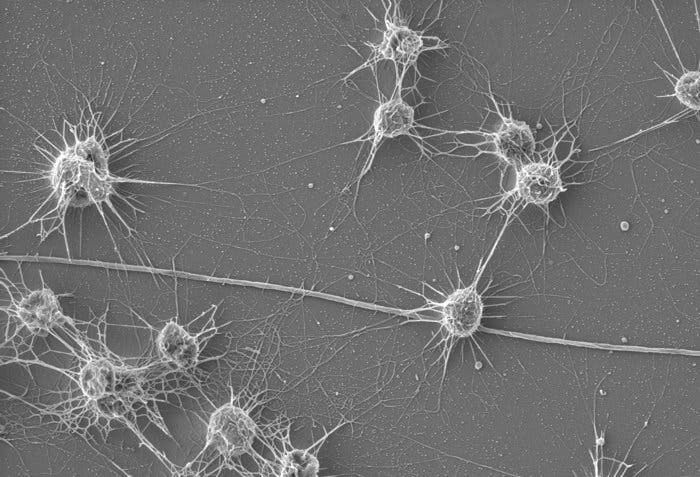 Altiarchaeales (Archaea) found in sulfidic springs in Germany. Credit: Medical University of Graz, Austria.