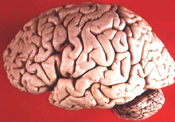 Human brain.