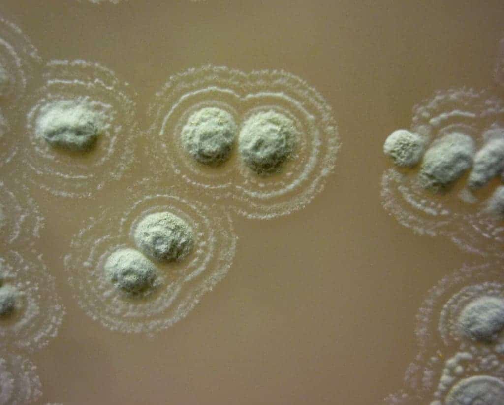 New bacteria strain.