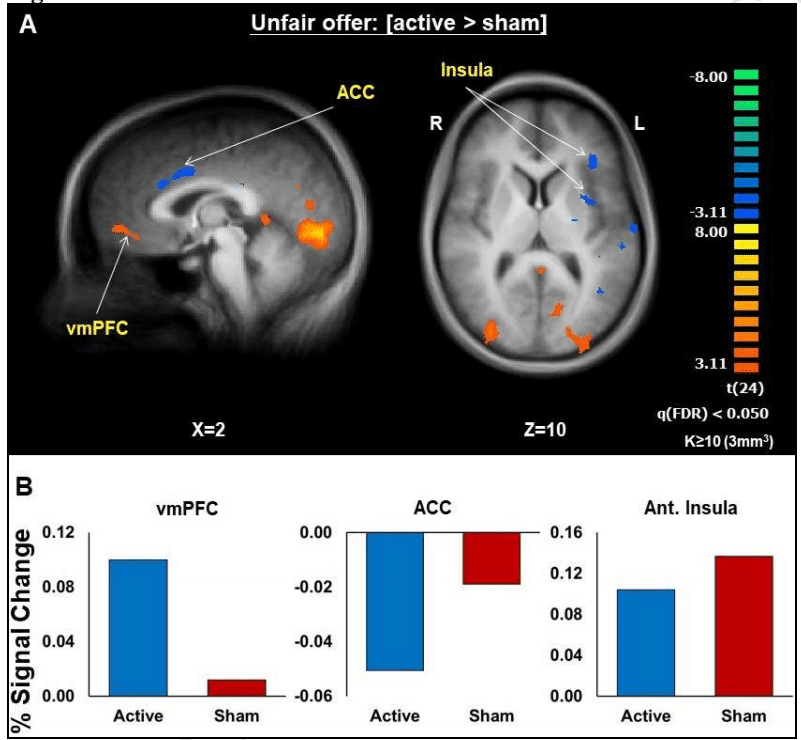  Active stimulation led to increased activity in the vmPFC.